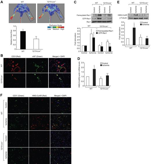 Figure 5. Lack of 12/15-Lox gene impairs blood flow recovery after ischemia. WT and 12/15-Lox−/− mice were subjected to hind-limb ischemia by left femoral artery excision. (A) On day 7 after hind-limb ischemia, blood flow was measured by Laser Doppler Perfusion Imager (LDPI). Perfusion was expressed as ratio of the ischemic to the non-ischemic hind limb. (B) Blood vessels in the ischemic adductor muscles of WT and 12/15-Lox−/− mice were analyzed by double immunofluorescence staining for CD31 (Red) and vWF (Green). (C) Ischemic and non-ischemic adductor muscle tissue extracts from WT and 12/15-Lox−/− mice were prepared and analyzed for Rac1 fanesylation and activation. (D-E) RNA and protein extracts were prepared from ischemic and non-ischemic adductor muscles of WT and 12/15-Lox−/− mice and analyzed for HMG-CoA reductase mRNA (D) and protein levels (E) by QRT-PCR and Western blotting, respectively, as described in Figure 3. (F) Ischemic and non-ischemic adductor muscle sections of WT and 12/15-Lox−/− mice were stained for CD31 (green) and HMG-CoA reductase (red). The bar graphs in panels A, C, D and E represent the mean ± SD values of 3 independent experiments or 6 animals. *P < .05 versus WT non-ischemia; **P < .05 versus WT ischemia.