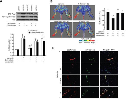 Figure 6. Mevalonate rescues Rac1 farnesylation and activation and blood perfusion from inhibition by simvastatin. (A) Tissue extracts were prepared from ischemic and non-ischemic adductor muscles of WT mice that were administered with or without simvastatin in combination with and without mevalonate and analyzed for Rac1 farnesylation and activation as described in Figure 3. (B) Blood flow was measured by LDPI. (C) Ischemic adductor muscle sections of WT mice that were administered with or without simvastatin in combination with and without mevalonate were stained for CD31 (red) and vWF (green). The bar graphs in panels A and B represent the mean ± SD values of 3 independent experiments or 6 animals. *P < .05 versus WT non-ischemia; #P < .05 versus WT ischemia. **P < .05 versus WT ischemia + simvastatin.