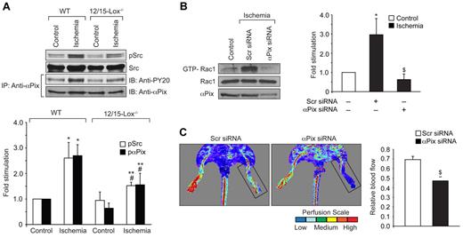 Figure 8. Down-regulation of αPix levels attenuate hind-limb ischemia-induced Rac1 activation and angiogenesis. (A) Tissue extracts were prepared from ischemic and non-ischemic adductor muscles of WT and 12/15-Lox−/− mice and analyzed for Src and αPix activation. To determine Src activation, its tyrosine phosphorylation was measured by Western blotting using its phospho-specific antibodies. Activation of αPix was measured as described in Figure 4A. (B) Tissue extracts were prepared from ischemic and non-ischemic adductor muscles of WT mice that received scrambled or αPix siRNA and analyzed for Rac1 activation by pull-down assay and αPix levels by Western blotting. (C) Blood perfusion was measured by LDPI in WT mice that received scrambled or αPix siRNA in response to ischemia. The bar graph represents the mean ± SD values of 3 independent experiments or 6 animals. *P < .05 versus WT non-ischemia; #P < .05 versus 12/15-Lox−/− non-ischemia; **P < .05 versus WT ischemia; $P < .05 versus WT ischemia + scr siRNA.