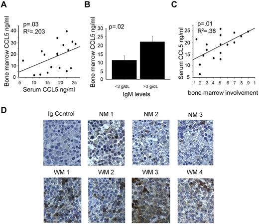 Figure 2. Elevated CCL5 expression correlates with disease activity. (A) Correlations between serum CCL5 and CCL5 in the bone marrow of patients with matched samples (n = 20). (B) Correlation between CCL5 levels in bone marrow plasma and IgM levels. (C) Correlation between CCL5 levels in serum and degree of bone marrow involvement by lymphoplasmacytic cells. (D) Immunohistochemical staining of CCL5 (brown) in bone marrow specimens of 3 healthy donors (NM1-NM3) and 4 WM patients (WM1-WM4) was performed using anti-CCL5 mAb as described in “Methods.” Images shown are original magnification ×400.