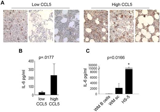 Figure 5. CCL5 levels correlated with IL-6 levels in WM. (A) Immunohistochemical staining for IL-6 in bone marrow biopsy specimens of 6 WM patient samples (3 with high CCL5 expression and 3 with low CCL5 expression) was performed using anti–IL-6 antibody as described in experimental procedures. Images shown are original magnification ×400. (B) Quantitative correlation of bone marrow IL-6 and CCL5 levels in bone marrow plasma samples from WM patients (n = 60). IL-6 and CCL5 levels were quantitated by ELISA as described in “Methods.” CCL5 levels were divided to high or low based on median value. (C) Average IL-6 production by HS-5 stromal cells (0.1 × 106 cells/well), CD19+CD138+ cells from WM patients (0.5 × 106 cells/well, n = 2 patients) and stromal cells generated from WM patients (0.1 × 106 cells/well, n = 4 patients) was determined using a human IL-6 ELISA.