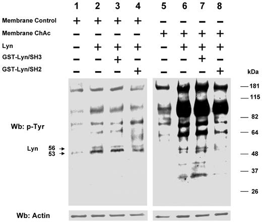 Figure 5. Phosphorylation patterns of normal and ChAc RBC membranes by exogenous Lyn. Membranes of high-density fraction (F2) of RBCs from control (C) and ChAc subjects were incubated without (lanes 1 and 5) or with exogenous Lyn (lanes 2-4 and 6-8) and with GST-Lyn/SH3 (lanes 3 and 7) or GST-Lyn/SH2 (lanes 4 and 8), respectively. Samples were then analyzed by Western blot (Wb) analysis with anti–phosphotyrosine antibodies. Similar data were obtained with F1 control and ChAc RBCs (data not shown). The membranes were reprobed with anti–actin antibody as loading control.