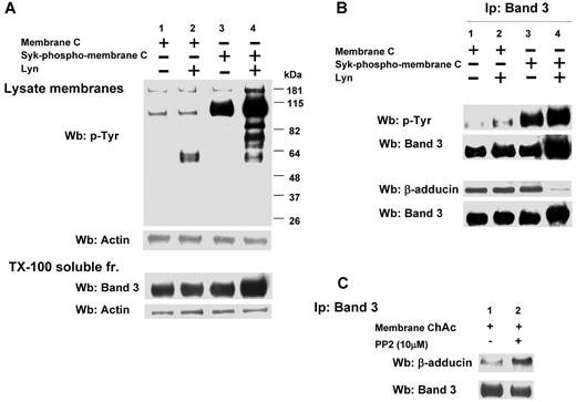Figure 6. Effect of phosphorylation of RBC membranes by Syk and/or Lyn on band 3 binding to β-adducin in normal and ChAc RBC membranes. (A) Membranes (lanes 1 and 2) or Syk-phospho-membranes (lanes 3 and 4) of F2 RBCs from control (C) were incubated without (lanes 1 and 3) or with exogenous Lyn (lanes 2 and 4) and subjected to Western blot analysis with anti–phospho-Tyr (anti–pTyr) antibody (top panel) or were extracted with Triton X-100 and assayed after ultracentrifugation for the presence of band 3 by Western blot analysis (bottom panel). The membranes were reprobed with anti–actin antibody as loading control. (B) Band 3 was immunoprecipitated from membranes (lanes 1 and 2) and Syk-phospho-membranes (lanes 3 and 4) of F2 RBCs from C after incubation without (lanes 1 and 3) or with exogenous Lyn (lanes 2 and 4). The immunoprecipitates were subjected to Western blot analysis with anti–pTyr (top panel), anti–β-adducin antibody. The blots were also probed with anti–band 3 antibody. (C) Band 3 was immunoprecipitated from membranes of F2 ChAc RBCs previously incubated without or with the inhibitor PP2 (10μM). The immunoprecipitates were subjected to Western blot analysis with anti–β-adducin antibody. The blots were also probed with anti–band 3 antibody. The figure is representative of 3 independent experiments.