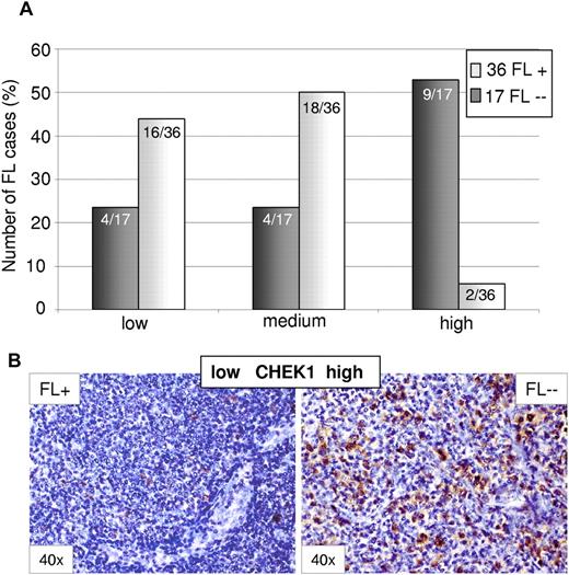 Figure 4. Differential expression of the miR-16 target CHEK1 between t(14;18)–positive (FL+) and t(14;18)–negative FL (FL--) without BCL2 expression as detected by immunohistochemistry. (A) CHEK1 expression was increased in t(14;18)–negative FLs (P < .001, likelihood ratio). (B) Representative stainings for CHEK1 in FL+ and FL--. Images were captured using a Olympus, Color View, BX50 microscope, the Color View digital camera, and the analysis work soft imaging system (all Olympus).