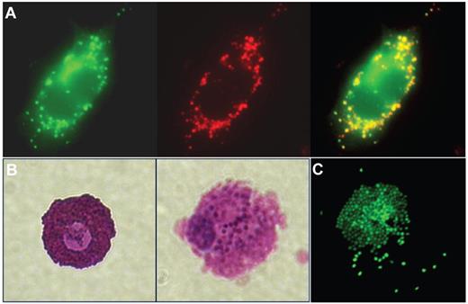 Figure 2. Particulate release of MC Mediators. (A) Rat lymphoblastic leukemia-2H3 cells (a MC-like cell line), which express a TNF–green fluorescent protein fusion protein (green), incorporate TNF and other mediators, including serotonin (red), into their granules. Colocalization of these markers can be viewed in the merged image where the overlapping areas appear yellow. The construction of these cells is described in Kunder et al4 (60×/1.40 NA, oil objective). (B) A resting MC (left) and a compound 48/80-activated mast cell (right), both obtained from rat peritoneal lavage, and stained with toluidine blue (60×/1.40 NA oil objective). (C) An activated, rat peritoneal MC stained with avidin to show the granules, some of which have diffused away from the cell after release as discrete particles. Confocal images were acquired using a Nikon Eclipse TE200 microscope and EZ-4 Version 3.6 software. Bright field images were captured using a Nikon Eclipse TE200 microscope and a Nikon Coolpix 4500 camera. Additional image processing was performed using Adobe Photoshop Version 9.