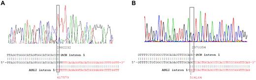 Figure 1. Sequence of the BCR-ABL1 rearrangements from twins 1A and 2A at diagnosis. The chromatogram and NCBI nucleotide blasts analysis of the BCR-ABL1 breakpoint DNA sequence with BCR intron 1 (NT_011520, black) and ABL1 intron 1 (NT_035014, red) sequences are shown for twins 1A (A) and 2A (B).