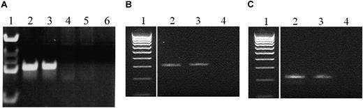 Figure 2. PCR amplification of the genomic BCR-ABL1 rearrangements from twins. (A) Genomic BCR-ABL1 rearrangements from twins 1A and 1B at diagnosis; lanes: 1, marker; 2, diagnosis twin 1A; 3, diagnosis twin 1B; 4 and 5, negative controls; 6, no DNA control. (B) Genomic BCR-ABL1 rearrangements from twin 2A at diagnosis and relapse; lanes: 1, marker; 2, diagnosis twin 2A; 3, relapse twin 2A; 4, no DNA control. (C) Genomic BCR-ABL1 rearrangements from twin 2A and healthy twin 2B (Guthrie specimens); lanes: 1, marker; 2, Guthrie card DNA twin 2A; 3, Guthrie card DNA twin 2B; 4, no DNA control.