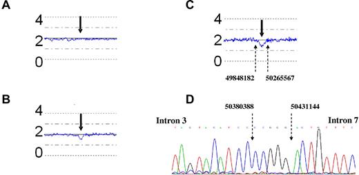 Figure 4. Copy number analysis of the IKZF1 locus in DNA at diagnosis with the use of CNAG 3.0. The blue lines indicate the mean CNA of 5 contiguous SNPs. The numbers 0, 2, and 4 refer to the genomic copy number. (A-C) The bold arrows point to the IKZF1 locus. (C) The fine dotted arrows indicate the genomic breakpoints (base pair location, NCBI35/Hg17) around the IKZF1 gene. (A) Twin 1A, (B) twin 1B, (C) twin 2A, and (D) twin 1A, IKZF1 sequence.