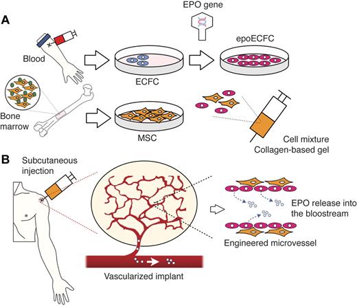 Figure 1. Combining ex vivo gene therapy and vascular network bioengineering: schematic diagram. (A) ECFCs and MSCs are obtained from the patient's own blood and BM, respectively. A gene encoding for hEPO is inserted into culture-expanded ECFCs, and the transfected cells (epoECFCs) are then selected out from the nontransfected ones. Culture-expanded epoECFCs and MSCs are combined in a collagen/fibrin–based gel and prepared for subcutaneous injection into the patient. (B) After injection, the transplanted cells engraft, forming a network of functional blood vessels that are connected to the patient's vasculature. The EPO-producing cells, epoECFCs, line the lumens of these bioengineered vessels. Consequently, EPO is readily secreted into the bloodstream of the patient and distributed systemically.