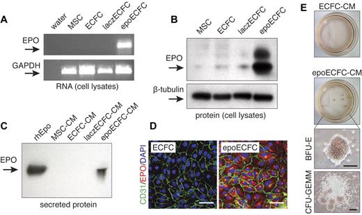 Figure 2. Transduction of ECFCs with rhEPO. Human CB-derived ECFCs were transfected using a lentivirus vector encoding for hEPO (epoECFCs) under control of a CMV promoter. laczECFCs, nontransfected ECFCs, and MSCs served as negative controls for EPO expression. (A) Expression of EPO at the mRNA level was only observed in epoECFCs by RT-PCR. (B) At the protein level, expression of EPO was confirmed in cell lysates by immunoblotting analysis. (C) EPO was also detected by immunoblotting analysis in epoECFC-CM, but not in CM from laczECFCs, ECFCs, or MSCs. (D) Immunofluorescent staining of cells in monolayer cultures using Abs against human CD31 (green) and hEPO (red) showed EPO expression only present in epoECFCs, not in nontransfected ECFCs. Cell nuclei were stained with DAPI. Scale bars indicate 50 μm. (E) Secreted EPO was confirmed to be functional in hematopoietic colony-forming assays. CB-derived mononuclear cells cultured in EPO-free methylcellulose medium containing epoECFC-CM developed EPO-dependent erythrocyte-containing colonies such as BFU-E and CFU-GEMM. Cultures containing control ECFC-CM did not generate BFU-E or CFU-GEMM colonies. Scale bars indicate 200 μm.
