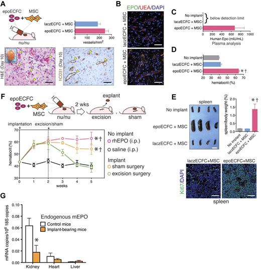 Figure 3. Vascular network formation and EPO delivery in vivo. (A) epoECFCs and MSCs were subcutaneously injected into nude mice. Macroscopic view of explant at day 10 is shown in the inset (scale bar indicates 2 mm). H&E and hCD31 immunohistochemistry showed formation of numerous blood vessels (yellow arrowheads; scale bar indicates 50 μm). Microvessel density was quantified at day 10 (n = 4). (B) Double immunofluorescent staining of microvessels using UEA binding (red) and an Ab against hEPO (green; scale bars indicate 50 μm). (C) HEPO detected by ELISA in plasma at day 10. (D) Hematocrit at day 10 (epoECFCs vs no implant, †P < .0001; epoECFCs vs laczECFCs, *P < .0001). (E) Macroscopic view of spleens at day 10 (scale bar indicates 10 mm). Spleens/body weight ratio (epoECFCs vs laczECFCs, †P < .005; epoECFCs vs no implant,*P < .005). Immunofluorescent staining using an Ab against Ki67 (green). Cell nuclei were stained with DAPI. Scale bars indicate 50 μm. (F) Hematocrit was monitored for 5 weeks; implants were surgically excised at 2 weeks. Sham-operated mice, and mice treated (IP) with rhEPO and saline served as control (all vs excision, *P < .001; all vs saline, †P < .001). (G) Quantitative RT-PCR analyses of endogenous mEPO expression in kidney, heart, and liver at 5 weeks (*P < .01).