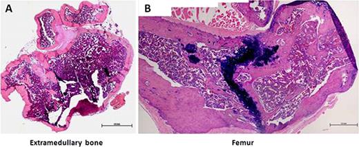 Figure 1. Establishment a human bone marrow microenvironment in NOD/SCID/IL-2r-gammanull mice. Representative hematoxylin and eosin (H&E) staining (shown at low magnification) shows an overview of the extramedullary bones with the typical bone structures. Scale bar: 1 mm.