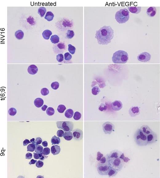 Figure 1. Skewing of LTC-IC assay suspension cells towards the myelomonocytic lineage upon anti-VEGFC treatment. MGG stained cytospins of suspension cells of the LTC-IC co-culture obtained during demi-depopulation at week 2.