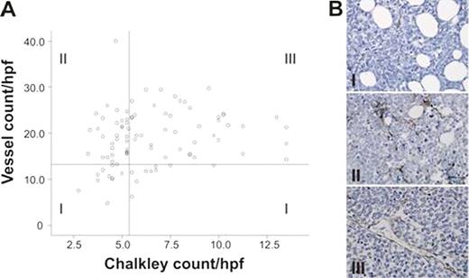 Fig. 1. AML biopsies prior to treatment divided into three morphology groups. (A) Scatterplot representing the AML biopsies at diagnosis. Biopsies with a ‘low vessel count’ are displayed below the Y-axis reference line (13 microvessels/hpf, group I). The X-axis reference line divides AML biopsies at diagnosis with a ‘high vessel count’ into two subgroups according to the median Chalkley count of 5.4 in AML at diagnosis. Cut-off points are based on previously described results. Samples with a Chalkley count ≤5.4 were defined as ‘angiogenic sprouting’ (group II) and samples with a Chalkley count >5.4 as ‘vessel hyperplasia’ (group III). (B) A representative picture of the three groups is shown.