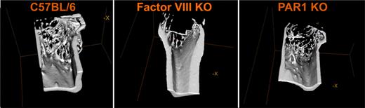 Fig. 1. Representative micro-CT analyses of tibial metaphyses revealing reduced bone/tissue volume ratio and trabeculae numbers by 57.13±6.53%, and 73.1±4.7% in F8KO and by 44.83±15.2% and 37.11±8.07% in PAR1KO mice, respectively.