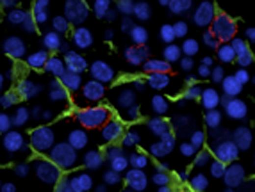 Figure 1. NL. / RA5Q. / RAEB2