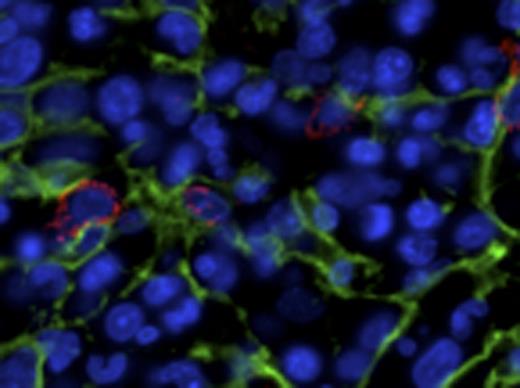Figure 1. NL. / RA5Q. / RAEB2