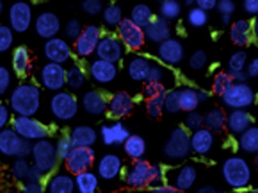 Figure 1. NL. / RA5Q. / RAEB2