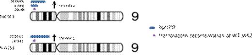 Figure 1. Karyoview of chromosomal aberrations in patients Na1061 and Na1253. Bars depict the physical position and size of the aberration (purple, HR; blue, 9pUPD events). Arrows indicate the chronology of events as deduced from the rs12343867 and V617F allelic ratios.
