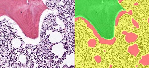 Figure 1. Image analysis pattern recognition was utilized to automatically identify bone (green)