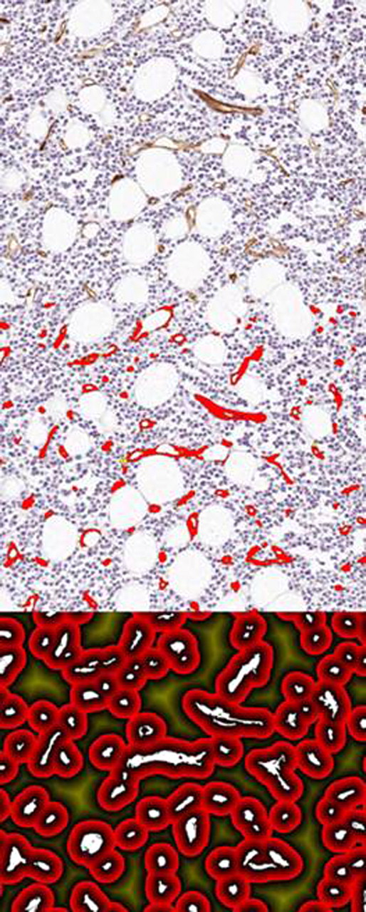 Figure 2. Image analysis process to identify vessels and then mark out a given distance from vessels for which to measure the percentage of plasma cells further than 20 microns from any vessel (area in dark yellow in bottom figure).