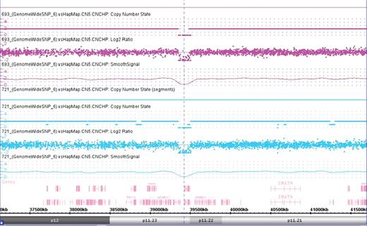 Figure 2. HZD at 8p11.23-p11.22 in two MGUS (CHAS software).
