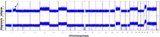 Figure 1. Comparison of CNV of patient 1 at diagnosis and relapse. The arrow indicates a large gain of genomic material on chromosome 1q detected in a relapse sample.