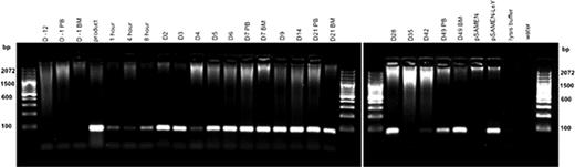 Figure 1. Patient 01 Genomic DNA was extracted from PB and BM samples and the presence of LeY tg (∼100 bp) assessed by PCR.