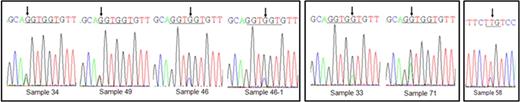 Figure 1. The detection of N-ras mutation by pyrosequencing and direct sequencing methods.