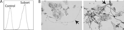 Figure 1:. Recombinant IgM of a novel B-CLL subset stain yeast . / (A) Subset-IgM stain Zymosan by flow cytometry. (B) Staining of yeast in infected cervical smears. Left: Control-IgM. Right: Subset-IgM. Arrows indicate yeast (in hyphal form).