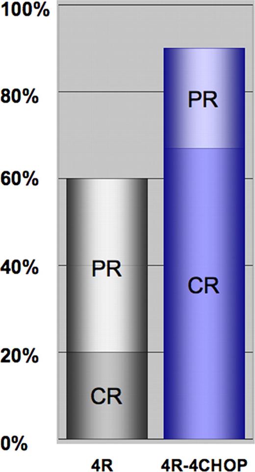 Figure 1:. CR and PR rates after four courses of rituximab monotherapy (4R) and after completion of therapy (4R-4CHOP).