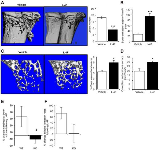Figure 7. L-4F prevents myeloma bone disease and increases bone volume and bone formation in non–tumor-bearing mice. (A) KaLwRij mice were treated with L-4F for 28 days before inoculation of 5TGM1 myeloma cells. Treatment was continued for a further 25 days, at which point mice were killed. Representative images of tibiae of vehicle and L-4F treated are shown. Osteolytic lesions through cortical bone were quantitated after micro-CT analysis. Vehicle, n = 9; L-4F, n = 10. (B) Bone formation rates in myeloma-bearing control and L-4F–treated mice were quantitated by dynamic histomorphometry. (C) KaLwRij mice were treated with L-4F for 28 days. Micro-CT analysis demonstrated a significant increase in trabecular bone volume. N = 5 per group. (D) Osteoblast number in control and L-4F–treated mice was quantitated by histomorphometry. (E) Adiponectin-deficient mice (KO) or WT controls were treated with L-4F for 28 days before inoculation of 5TGM1 myeloma cells. Treatment was continued for a further 25 days, at which point mice were killed. Trabecular bone volume was quantitated by micro-CT analysis, and rates of bone formation were quantitated by dynamic histomorphometry (F). (E-F) Data are presented as percentage change in response to treatment with L-4F. Data are mean ± SEM. *P < .05 and ***P < .001, compared with vehicle. #P < .05, compared with WT.