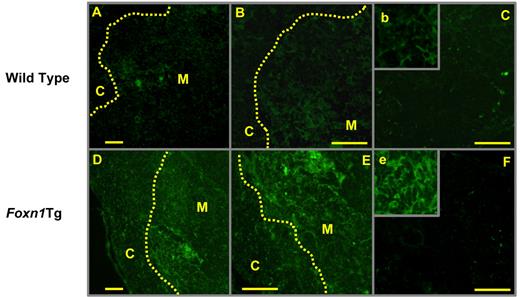 Figure 2. Detection of Foxn1-expressing stroma cells in the thymus of WT and Foxn1 Tg mice (2-3 months) by immunofluorescent staining. Frozen sections (4-5 μm) were fixed in acetone and stained with a rabbit anti-Foxn1 antibody (IgG fraction) or purified rabbit IgG control antibody, followed by incubation with FITC-conjugated goat anti–rabbit IgG F(ab)2′. (A-B,D-E) Stained with anti-Foxn1 antibody. (C,F) Stained with purified rabbit IgG antibody. Slides were studied using Zeiss LSM 510 confocal microcopy (A,C-D,F, original magnification 25×/0.8 W; B,E, original magnification 40×/1.2 W). Insets b and e represent an enlargement of the medulla regions in panels B and E, respectively. Scale bars represent 50 μm.