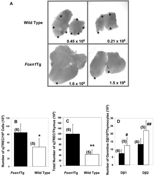 Figure 3. Gross morphology and TCR rearrangement in aged WT and Foxn1Tg. (A) Gross morphology of thymi from 2 WT (top) and 2 Foxn1Tg (line 60) mice 13 months of age (bottom). The numbers denote total number of thymocytes obtained from each thymus. *Translucent/fatty areas of the thymus. (B-C) Rearrangement of TCR-α chain was measured as the number of sjTREC/105 thymocytes (B), and total number of sjTREC/thymus (C) in old (12-15 months of age) Foxn1Tg (line 60 and line 5) and WT mice. (D) D-J rearrangement of TCR-β chain was determined by the number of germline copies of Dβ1 and Dβ2; black bars represent Foxn1 Tg; and white bars, WT mice. Quantitative PCR was used for both assays; each sample was performed in triplicates. Values in parentheses indicate the numbers of mice in each group. P values from comparison between WT and Foxn1Tg mice as determined by t test are as follows: *P = .019; **P = .004; #P = .040; ##P = .063.