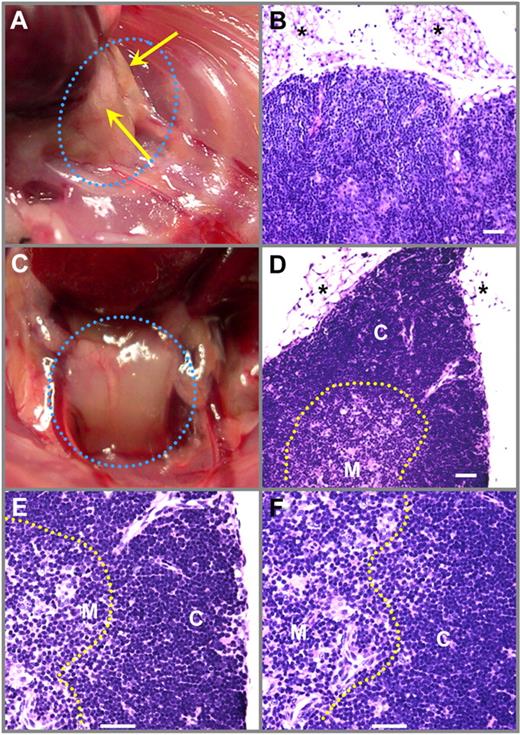 Figure 5. Changes in gross thymic morphology and histology of old WT and Foxn1 Tg mice (line 60). (A) Gross thymic morphology of a 26-month-old WT mouse with adipose tissue present (arrows). (B) H&E staining of the same thymus shows the loss of cortical-medulla demarcation and the abundance of adipose tissue (*). (C) Gross thymic morphology of a 31-month-old Foxn1Tg mouse with intact parenchymal tissue with little adipose tissue deposition. (D-F) H&E staining of the same thymus shows a clear cortical-medulla demarcation and little adipose tissue deposition. Images were acquired with a Leitz Diaplan microscope with a 25×/0.6 W (B-D) and 50×/1.0 W equipped with Religa 2000R camera and QImaging Pro software (Version 6.0). Scale bars represent 50 μm.