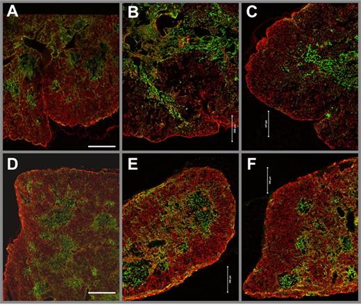 Figure 6. Double-staining of cortical keratin 8 (red) and medullary keratin 5 (green) in the thymus of WT and Foxn1Tg mice (line 60). Acetone-fixed frozen sections of thymi from 2-month-old (A) and 26-month-old (B-C) WT mice and 2-month-old (D) and 31-month-old (E-F) Tg mice were stained with a rabbit-anti–mouse keratin 5 (green) and rat-anti–mouse keratin 8 (red). Sections were analyzed with a Zeiss LSM 510 confocal microscope. Images were obtained with CApo 40×/1.2 W with a 2 × 2 matrix and digitally stitched using the LSM 510 software. Scale bar represents 200 μm.