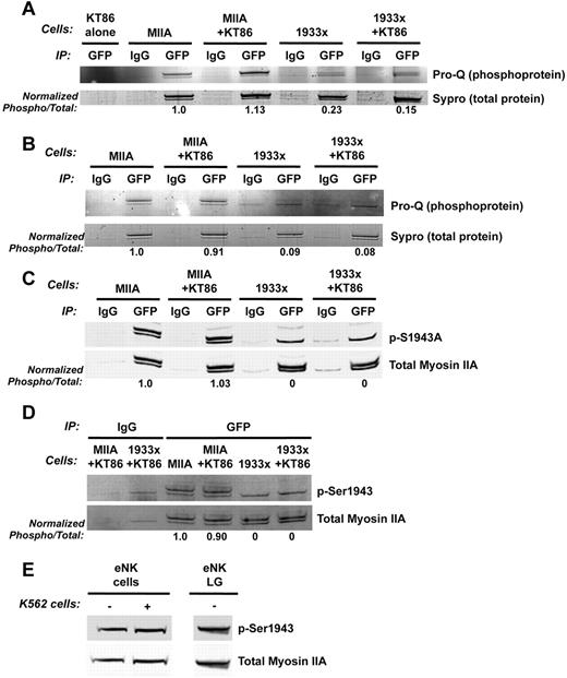 Figure 3. Myosin IIA is constitutively phosphorylated at S1943. (A-D) YTS cells expressing wild-type myosin IIA-GFP (MIIA) or 1933x myosin IIA-GFP (1933x) were left resting or were conjugated to KT86 target cells. GFP-tagged proteins were immunoprecipitated from lysates (A,C) or from the supernatants of isolated lytic granules that were treated with NaCl to remove surface proteins (B,D). GFP immunoprecipitates were evaluated by gel staining for phosphorylation (Pro-Q) and total protein (Sypro) (A-B), or by Western blot for phospho-S1943 and total myosin IIA (C-D). In all gels of GFP immunoprecipitates, lanes were loaded for equal GFP-myosin content to facilitate comparison of phosphorylation, and therefore the 1933x lanes contain greater total protein. In panels A through D, numbers below blots indicate the ratio of the phosphorylated band intensity to the total protein intensity for the GFP-tagged protein (upper band) normalized to the ratio for myosin IIA. In each image, there are 2 myosin bands: the larger corresponds to 253 kDa and represents the myosin IIA GFP fusion, which is enriched in the immunoprecipitates; the smaller corresponds to 227 kDa and represents the endogenous myosin IIA. The inclusion of 2 heavy chains in each myosin hexamer enables association of exogenous and endogenously expressed myosin IIA molecules when evaluated via immunoprecipitation (see also supplemental Figure 1). (E) Resting and stimulated ex vivo human NK-cell lysates and lytic granules isolated from resting eNK cells evaluated by Western blot for phospho-S1943 and total myosin IIA. Results are representative of 3 (A-E, eNK) or 2 (E, LG) independent assays.