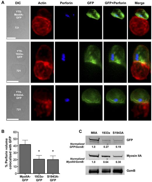 Figure 5. The myosin IIA tailpiece and S1943 phosphorylation are required for its interaction with lytic granules. (A) Confocal fluorescent micrographs of YTS cells expressing wild-type myosin IIA-GFP (MyoIIA-GFP), 1933x myosin IIA-GFP (1933x-GFP), or S1943A myosin IIA-GFP (S1943A-GFP) conjugated to 721.221 target cells (721) Differential interference contrast (DIC, left) in addition to fluorescent signal for actin (red), perforin (blue), or GFP-myosin (green) are shown, along with an overlay of fluorescent channels (right). Scale bar indicates 5 μm. (B) Percentage of total perforin fluorescent volume colocalized with GFP volume ± SD; > 20 cells per condition were analyzed. (C) Western blot of isolated lytic granules from resting YTS cells expressing wild-type myosin IIA-GFP (MIIA), 1933x myosin IIA-GFP (1933x), or S1943A myosin IIA-GFP (S1943A). GFP, myosin IIA, and granzyme B (GzmB) blots are shown. Gel was loaded for equal granule protein content to facilitate comparison of GFP-myosin quantity on lytic granules. Numbers below blots indicate the ratio of the GFP, and the myosin band intensities to the total intensity for granzyme B normalized to the ratio for MIIA. Results shown are representative of 3 independent assays.