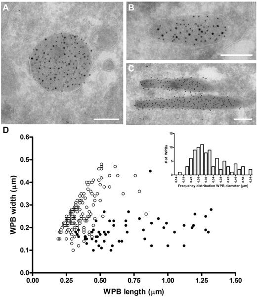 Figure 1. Rounded, electron-dense structures are positive for both FVIII and VWF. (A-C) TEM views of immunogold-labeled WPBs from FVIII-GFP–transduced BOECs, double-labeled with anti–VWF (10 nm gold), and anti-GFP (15 nm gold) to detect FVIII-GFP. Scale bars represent 200 nm. (A) WPBs positive for VWF and FVIII mostly had a rounded morphology. (B) Intermediate, “pear”-shaped WPBs containing both FVIII and VWF. (C) Elongated WPBs are only positive for VWF. (D) Size distribution of WPBs found in nontransduced and FVIII-transduced BOECs. FVIII-negative WPBs (●) had an average length and width of 701 ± 29 nm and 186 ± 58 nm (mean ± SD), respectively. On the other hand, FVIII-positive WPBs (○) were 360 ± 111 nm by 269 ± 81 nm (mean ± SD). Data includes both round and intermediate shaped FVIII-positive WPBs. (Inset) Diameter range of 88 selected FVIII-containing WPBs from panel D that were truly round.