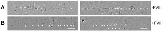 Figure 4. VWF strings released from FVIII-containing WPBs show reduced platelet binding properties. Two images of nontransduced (A) and FVIII-GFP-transduced (B) BOECs stimulated with 100μM histamine at 2.5 dyne/cm2 for 10 minutes and subsequently perfused with washed human platelets for 5 minutes. Platelet binding to VWF strings originating from nontransduced BOECs is more pronounced than platelet binding to strings released from FVIII-expressing BOECs. Scale bars represent 100 μm. Arrowheads indicate platelets bound to VWF strings released by FVIII-GFP-transduced BOECs. Images were taken on a confocal laser scanning microscopy using a Zeiss LSM510 equipped with Plan NeoFluar 40×/1.3 oil objective (Carl Zeiss) at 37°C.