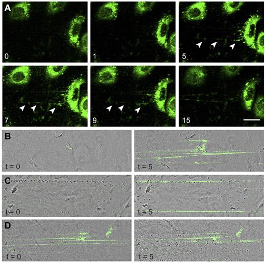 Figure 5. FVIII-containing, rounded WPBs release UL-VWF strings covered with FVIII. (A) FVIII-GFP–transduced BOECs were stimulated with 100μM histamine at 2.5 dyne/cm2. Shown are fluorescent images taken at indicated time points (in minutes) after the onset of flow. Green represents FVIII fluorescence. Arrowheads indicate released patches and strings. Scale bar represents 20 μm. (B) Nontransduced BOECs were stimulated with 100μM histamine at 2.5 dyne/cm2 for 10 minutes to stimulate exocytosis of WPBs and subsequently incubated with 5 U/mL purified FVIII-YFP for 5 minutes. Images were taken at the indicated time points (in minutes) after the onset of FVIII-YFP perfusion. (C) Nontransduced BOECs were stimulated with 100μM histamine at 2.5 dyne/cm2 for 10 minutes and subsequently incubated with washed platelets for 5 minutes before addition of 5 U/mL purified FVIII-YFP for 5 minutes. (D) Nontransduced BOECs were stimulated with 100μM histamine at 2.5 dyne/cm2 for 10 minutes, incubated with 5 U/mL purified FVIII-YFP for 5 minutes, followed by perfusion of washed human platelets for 5 minutes. Live-cell imaging was performed at 37°C on a confocal laser scanning microscopy using a Zeiss LSM510 equipped with Plan NeoFluar 40×/1.3 oil objective (Carl Zeiss) at 37°C.