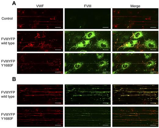 Figure 6. FVIII Y1680F variant binds to VWF strings when expressed by BOECs or exogenously added. (A) Nontransduced, FVIII-YFP-, and FVIII-YFP Y1680F-transduced BOECs were stimulated with 100μM histamine at 2.5 dyne/cm2, fixed and stained for VWF (red) and FVIII (green). (B) Nontransduced BOECs were stimulated with 100μM histamine at 2.5 dyne/cm2 followed by perfusion with 5 U/mL purified FVIII-YFP or 5 U/mL FVIII-YFP Y1680F. Cells were fixed and stained for VWF (red) and FVIII (green). Scale bars represent 20 μm.