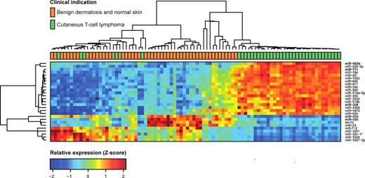 Figure 1. Expression profiles in training set for highly significant miRNAs. We analyzed microarray measurements of 688 miRNAs in the training set of 90 samples with t tests to discover differences in expression between samples of subjects with CTCL and those of BDN subjects. The 27 miRNAs that displayed highly significant (Bonferroni corrected P < .001) and strong differences (at least 50% change) are presented in the heat map. Samples are arranged in columns, miRNAs in rows, and both are hierarchically clustered using Euclidean distance with average linkage of nodes. Red-to-yellow shades indicate increased relative expression; blue shades indicate reduced expression; green indicates median expression. The top 5 most significantly induced or repressed miRNAs are shown in bold.