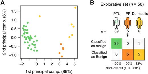 Figure 4. Classification of PTL and dermatitis. (A) PCA plot of samples from subjects with PTL (green), dermatitis (light orange), and psoriasis (yellow) for comparison, in the explorative set, based on the 5-miRNA profile. (B) Classification performance in the explorative set using the trained NSC algorithm. See Table 1 for explanation of PP.