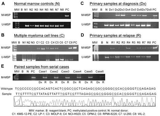 Figure 1. Methylation of MIR34B/C. (A) U-MSP showed that the methylated control PC was totally methylated, and all 8 normal controls (N1-N8) were unmethylated. In the M-MSP, the methylated control was methylated, but all normal controls were totally unmethylated. (B) For the cell lines, KMS-12-PE, LP-1, and NCI-H929 were completely methylated, MOLP-8, OPM-2, and WL-2 were hemizygously methylated, but RPMI-8226 and U-266 were unmethylated of MIR34B/C. (C) Methylation of MIR34B/C in primary myeloma marrow samples at diagnosis (Dx) and (D) at relapse/progression (R). (E) Sequence analysis of M-MSP product from bisulfite-treated relapsed myeloma DNA showed that the cytosine (C) residues of CpG dinucleotides were methylated and remained unchanged, whereas the other C residues were unmethylated and were converted to thymidine (T).