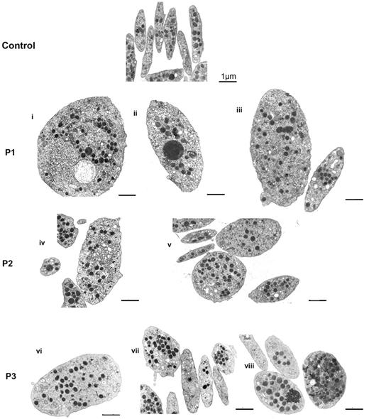 Figure 1. Effect of FLNA mutations on platelet morphology. Typical illustrations of platelet morphology as seen for each patient by EM. Discoid control platelets are homogeneous in size, and the α-granules are distributed homogeneously. Several examples are shown for each patient (P1-P3). Note the presence of size heterogeneity with enlarged more rounded platelets intermingled with discoid platelets of normal size. Heterogeneity also is noted in the α-granule content (i,iii,v-vii) with some platelets having few granules (v,vii), whereas giant granules are occasionally seen (ii,iv). Zones enriched in membrane complexes are seen in some giant platelets (i,iv). Bars indicate 1 μm for all EMs.