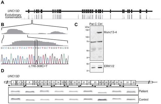 Figure 1. Characterization of a UNC13D intron 1 mutation. (A) Evolutionary nucleotide conservation (gray bars) as predicted by the AlaMut algorithm relative to intronic (black line) and exonic (black boxes) regions of UNC13D. (B) The nucleotide exchange c.118-308C > T is located in a highly conserved region of intron 1. The c.118-308C > T mutation was identified in 7 patients (6 families) in a heterozygous state and in one patient in a homozygous state. (C) PBMCs from patient C and a healthy control were lysed, and protein content was analyzed by SDS-PAGE and Western blotting. Rabbit polyclonal antibodies for detection of Munc13-4 and ERK1 and 2 were used. (D) Nine different primer pairs were used for amplification of overlapping, consecutive UNC13D cDNA fragments. The amplified fragments from patient E, carrying the intron 1 mutation c.118-308C > T in a homozygous state, and a healthy control were separated by gel electrophoresis and are shown relative to their position in the UNC13D transcript.