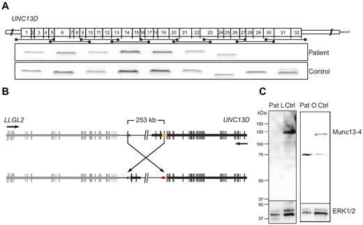 Figure 3. Characterization of an UNC13D inversion. (A) Nine different primer pairs were used for amplification of overlapping, consecutive UNC13D cDNA fragments. The amplified fragments from a patient (representative of 3 analyzed patients) and a healthy control were separated by gel electrophoresis and are shown relative to their position in the UNC13D transcript. (B) Schematic illustration of a 253-kb inversion identified in patients with FHL. The breakpoints are located in Alu elements containing an identical sequence of 25 bp. Two elements, AluSc8 and AluSx1 (yellow, orange), are located on the reverse strand in intron 30 UNC13D, and an AluY (red) element is located 253 kb upstream of UNC13D on the forward strand. (C) PBMCs from patient O, patient L, and healthy controls were lysed, and protein content was analyzed by SDS-PAGE and Western blotting. Rabbit polyclonal antibodies for detection of Munc13-4 and ERK1 and 2 were used.