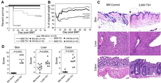 Figure 1. A TCR Tg model of GVHD. (A-B) HA104 mice received 750cGy and 8 × 106 BALB/c RAG−/− BM cells alone or in combination with 9000, 3000, or 1000 sorted TS1 TN. As an additional control, wt mice received BM cells in combination with 3000 TN. Shown are survival (A) and weight loss (B). P values are relative to BM only controls. Data are representative of 2 independent experiments. (C-D) HA104 mice received 750cGy and 8 × 106 RAG−/− BM cells alone or in combination with 3000 sorted TS1 TN. On day 21, mice were killed and tissues were taken for histopathology analysis. Representative skin, colon, and liver pathology are shown in panel C. Pathology scores are shown in panel D. Pathology data were combined from 2 independent experiments.