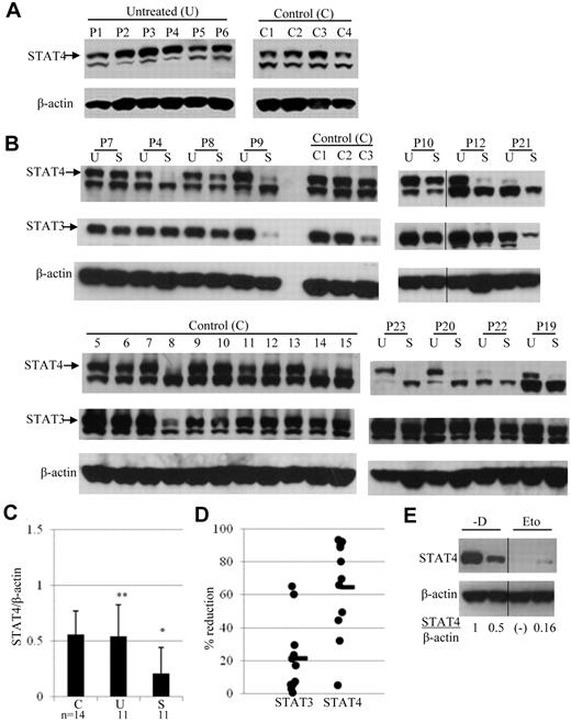 Figure 1. Expression of STAT4 in cells obtained before and after chemotherapy. (A) STAT4 protein expression was analyzed by immunoblotting of PBMCs from 4 healthy controls (C1-C4) and 6 untreated lymphoma patients (P1-P6). Samples from controls and patients were run in separate gels and exposure was done at the same time. The indicated upper STAT4 band detected with anti-STAT4 mAb was confirmed with anti-STAT4 polyclonal Ab.15 (B) Immunoblot analysis of STAT4 protein levels in control (C1-C3 and C5-C15) and lymphoma patient (P4, P7-P10, P12, P19-P23) PBMCs. Lymphoma patient PBMCs were obtained before (lanes labeled “U” for untreated) and 3 weeks after (lanes labeled “S” for standard dose) their first cycle of standard-dose chemotherapy plus rituximab. The chemotherapy regimen was R-CVP for patients P1, P6, P10, and P20 and R-CHOP for all other patients. A vertical line has been inserted to indicate the repositioned gel lane. (C) The levels of STAT4 protein in panel B were quantified by densitometry of the corresponding bands using the National Institutes of Health ImageJ program, and each sample was normalized to endogenous control β-actin as the ratio. Results are presented as means ± SD from 14 control and 11 patient samples. Blots in panel B were run in different gels but exposed to the same extent. *P < .05 relative to controls (C) or untreated lymphoma patients (U); **P > .05 relative to controls (C). (D) Changes in STAT4 and STAT3 protein levels in PBMCs obtained from each patient after standard-dose chemotherapy (S) are presented as the percentage of reduction compared with PBMCs obtained before chemotherapy treatment (U). The average percentage of reduction was obtained from the same 11 patients as in panel B and shown as the horizontal line in the graph. (E) Analysis of STAT4 protein in mice treated without or with etoposide. Tumor-bearing mice were treated with vehicle or etoposide as described in “Methods.” Spleens were harvested from 2 mice killed on day 29 of study. CD4+ T cells were isolated from each spleen using positive selection with CD4 magnetic beads (Miltenyi Biotec). Total protein extracts from isolated cells were subjected to immunoblotting analysis. The level of STAT4 protein in each mouse was normalized to internal control β-actin and is presented as the ratio indicated below. Nondetectable STAT4 protein is presented as (-). Results shown are representative from 2 independent studies. A vertical line has been inserted to indicate the repositioned gel lane.